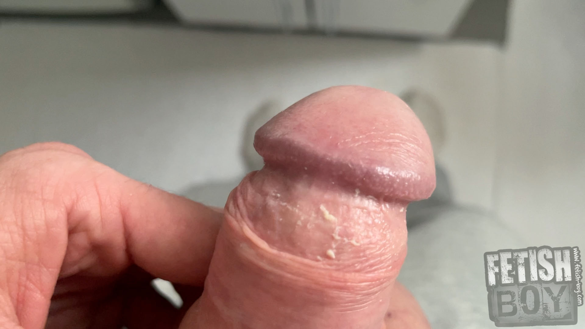 Exploring the Cheese Under My Foreskin